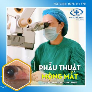Điều Trị Mộng Mắt (Mộng Thịt) tại Bệnh viện Mắt Quốc tế Sài Gòn - Gia Lai